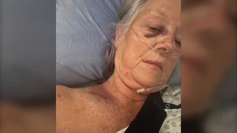 Vancouver senior seriously injured in hit-and-run speaks from hospital